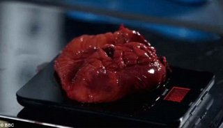 BBC拍片首次揭幕肥胖者“器官”4