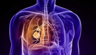 Nat Med检测循环肿瘤细胞就可准确预测肺癌化疗效果1&nbsp;