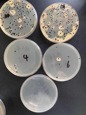 探索微生物世界 菌落計數方法的發展
