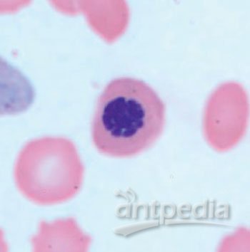 图片B：薄血液涂片里的有核红细胞（图片蒙美国疾控中心惠赐）。
