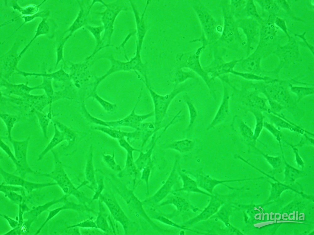 成纤维细胞(图1)