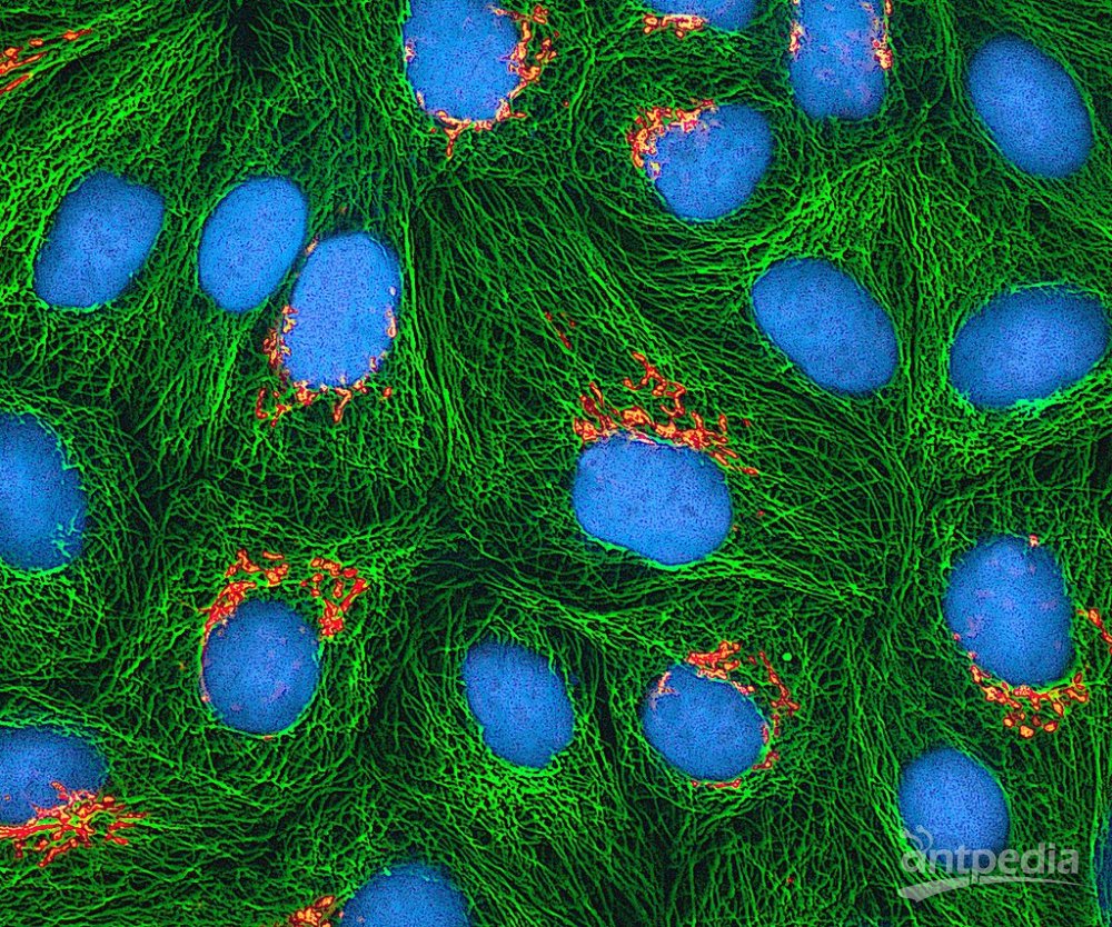 海拉细胞(图1)