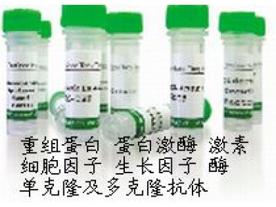 MouseAntiHumanHexokinase-3（HK3）