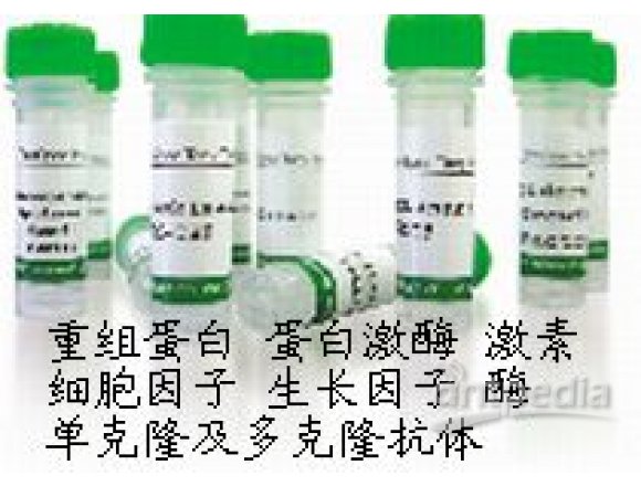 MouseAntiHumanHexokinase-3（HK3）
