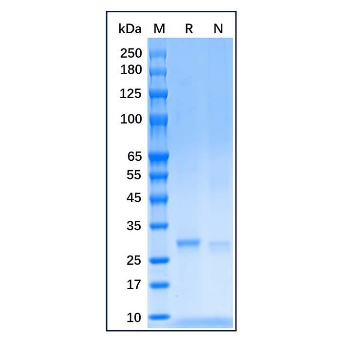 Recombinant Human SDHB Protein，Carrier Free, Azide Free, ≥90%(SDS-PAGE