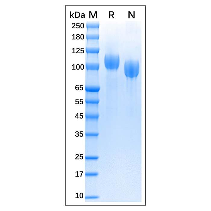 Recombinant Bovine CD56 Protein，Animal <em>Free</em>, Carrier <em>Free</em>, Azide <em>Free</em>, ≥95%(SDS-PAGE)