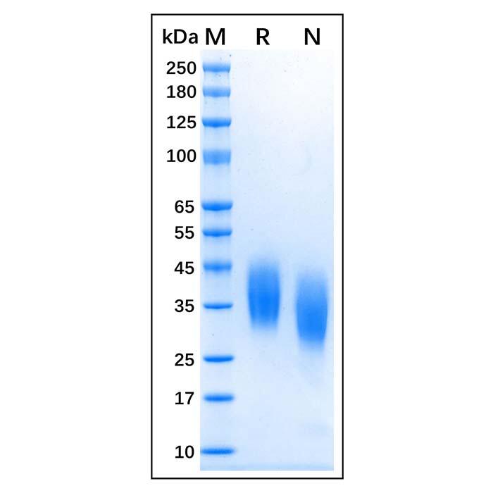 Recombinant Feline CD16 Protein，Animal <em>Free</em>, Carrier <em>Free</em>, Azide <em>Free</em>, ≥95%(SDS-PAGE)
