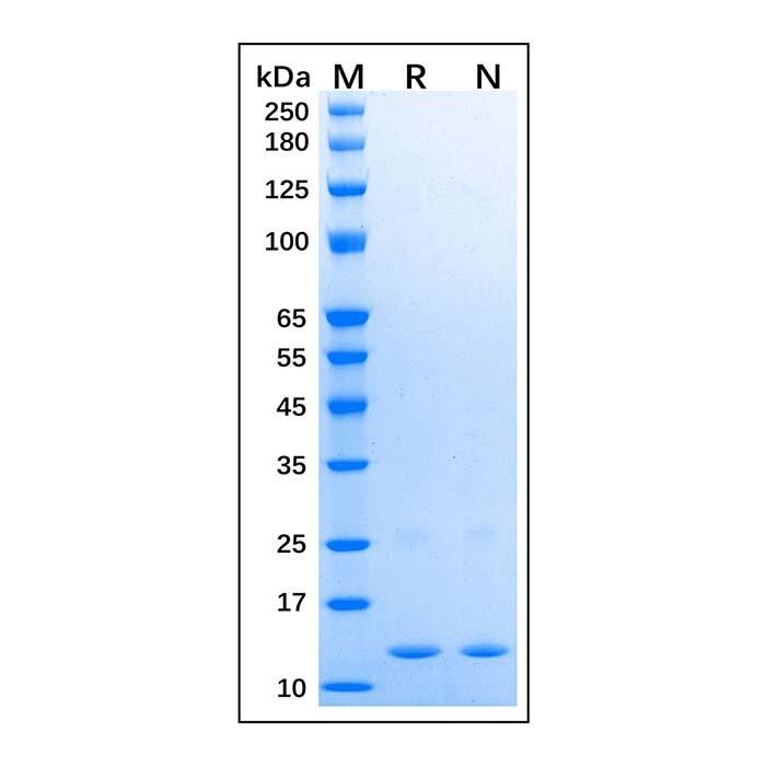 Recombinant Human SAA1 Protein，Carrier Free, Azide Free, ≥90%(<em>SDS</em>-PAGE)