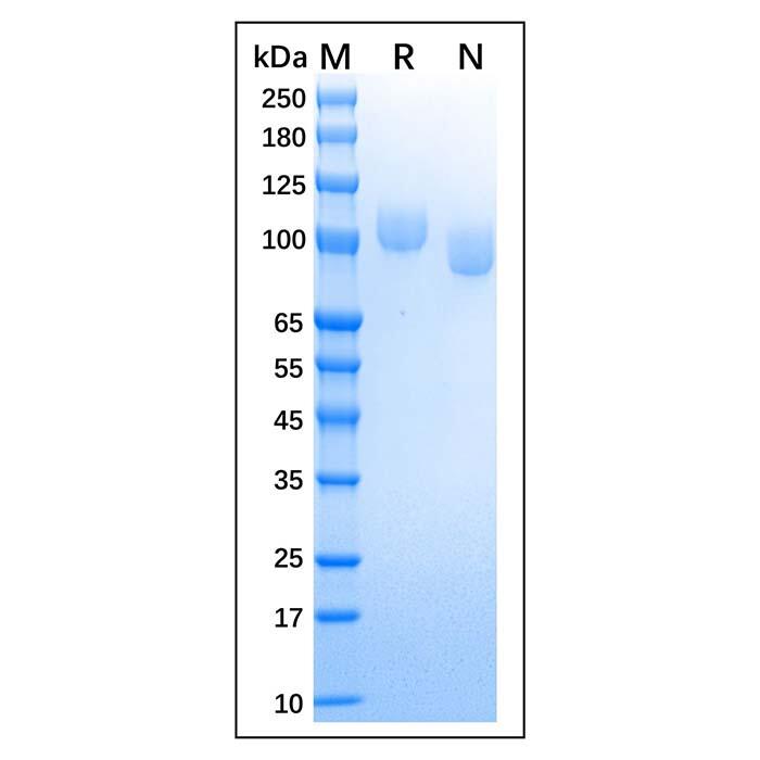 Recombinant Canine CD56 Protein，Animal Free, Carrier Free, Azide Free, ≥95%(<em>SDS-PAGE</em>)