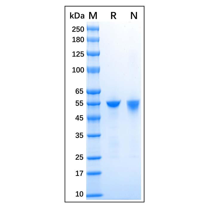 Recombinant Human <em>ALDH1A1</em> Protein，Carrier Free, Azide Free, ≥95%(SDS-PAGE)