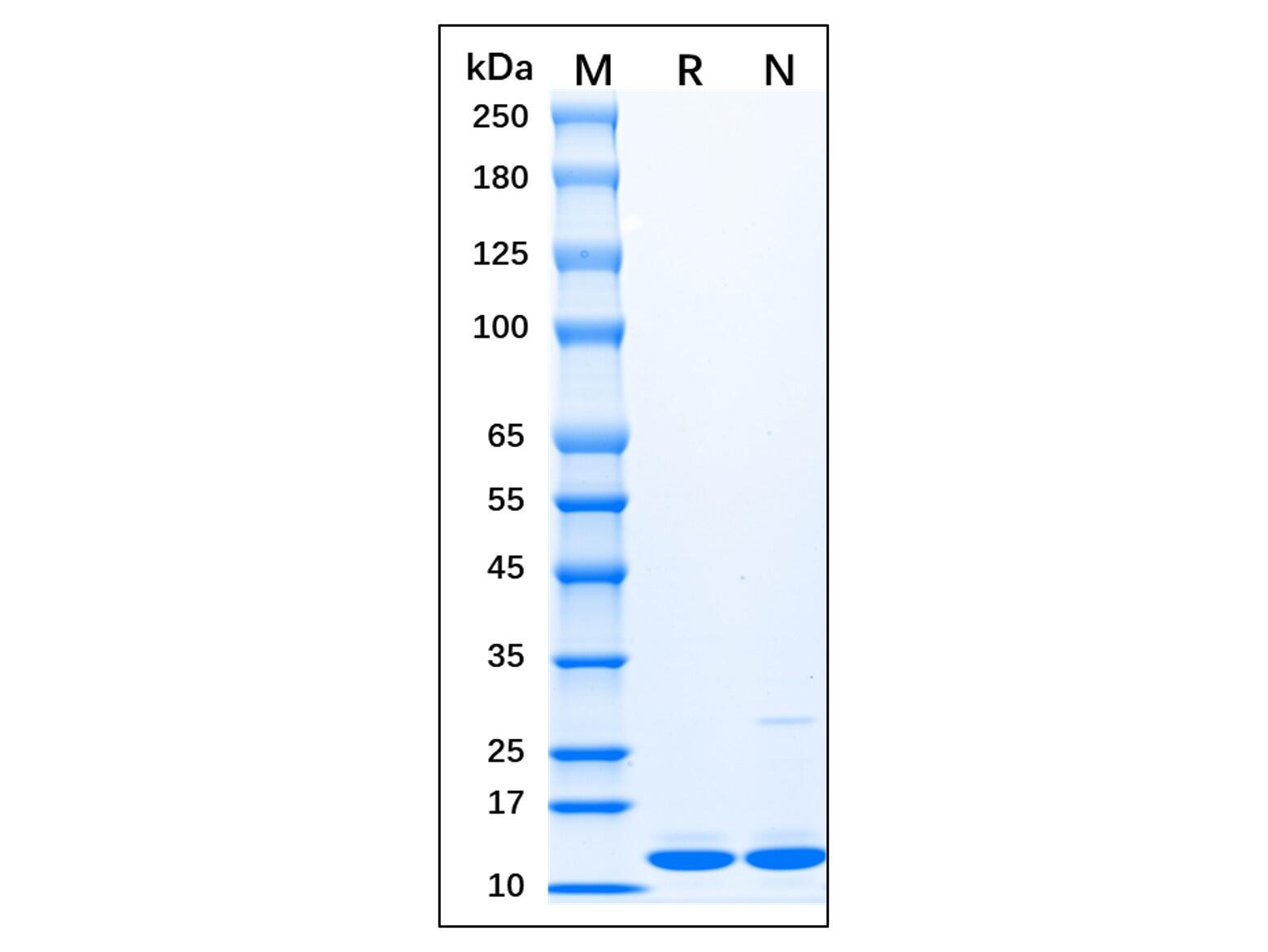 Recombinant <em>Human</em> <em>Doublecortin</em> Protein，Carrier Free, Azide Free, ≥90%(SDS-PAGE)