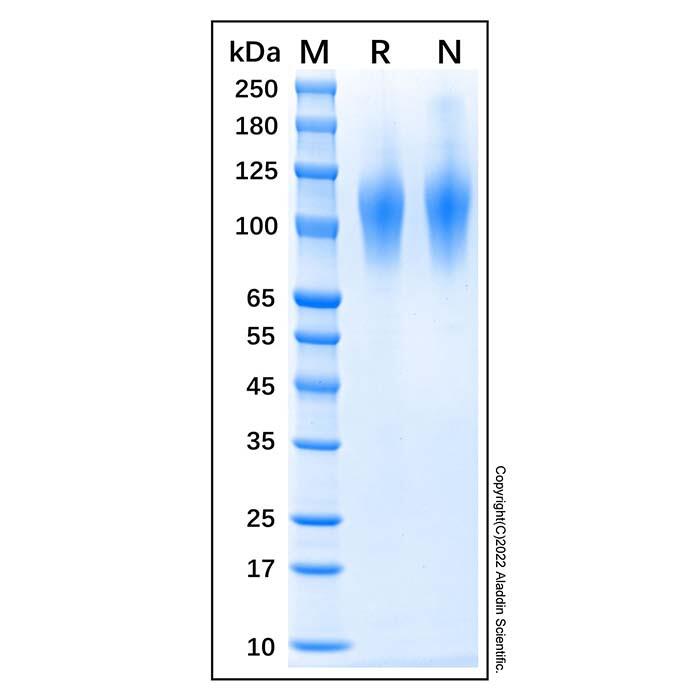 Recombinant Human CD68 Protein，Animal <em>Free</em>, Carrier <em>Free</em>, Azide <em>Free</em>, ≥90%(SDS-PAGE)