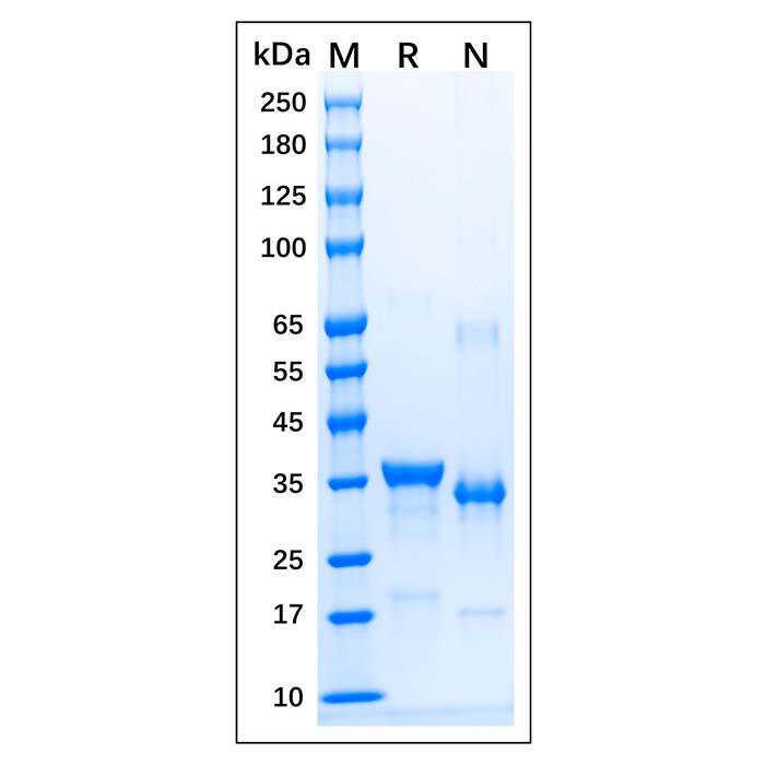 Recombinant Human <em>iNOS</em> Protein，Carrier Free, Azide Free, ≥90%(SDS-PAGE)