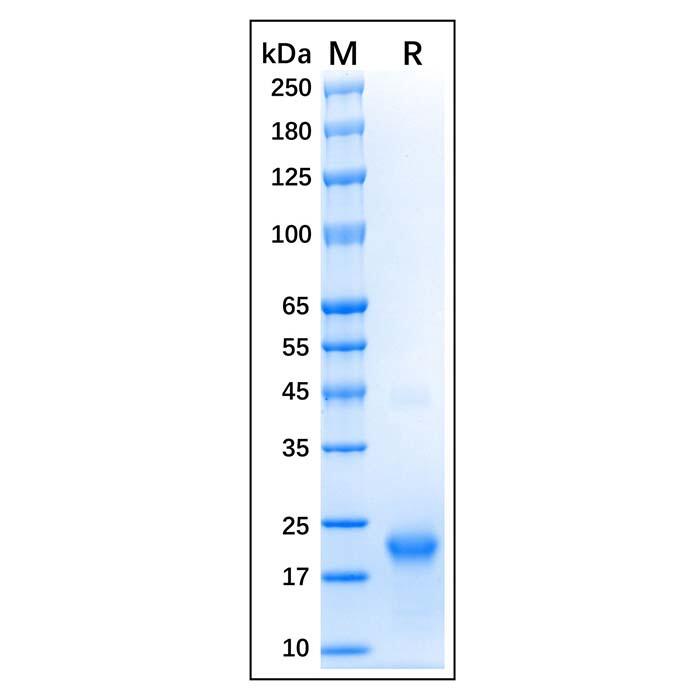 Recombinant Human GTPase HRAS Protein，Carrier Free, Azide Free, ≥95%(<em>SDS</em>-PAGE)