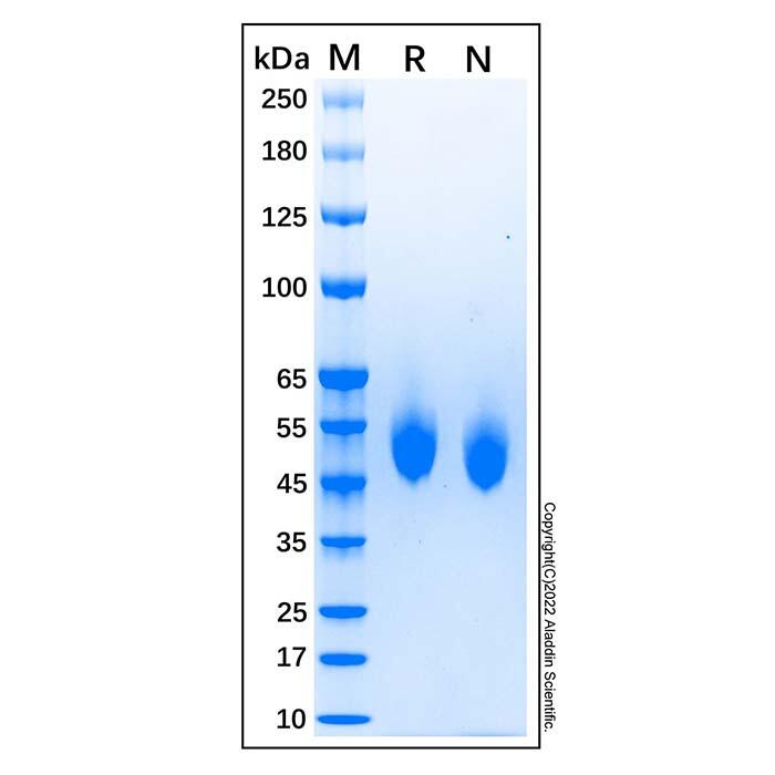 Recombinant Canine CD4 Protein，Animal <em>Free</em>, Carrier <em>Free</em>, Azide <em>Free</em>, ≥95%(SDS-PAGE)
