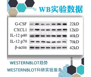 WB实验提供原始数据/western blot趋势/westernblot科研实验服务