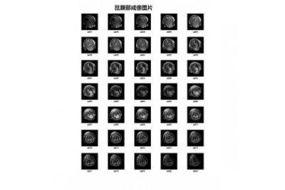 寰彤核磁NMRHT-MRSI60-25  (25mm)1.5T磁共振分子影像系统