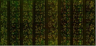 人转录<em>因子</em><em>相关</em>基因cDNA芯片