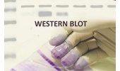 Western Blot检测