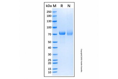 Recombinant Human Desmocollin-3 Protein，无动物源, 无载体, ≥95%(SDS-PAGE), 见COA