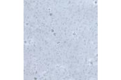 Transwell细胞迁移实验