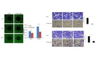 肿瘤新药靶IncRNA双细胞研究方案