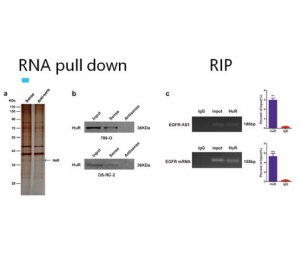 肿瘤新药靶IncRNA双细胞高级研究方案