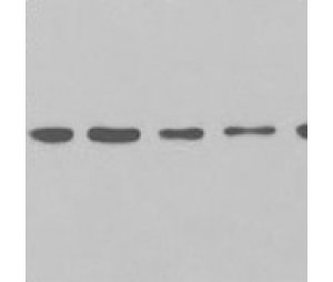 WB蛋白质印迹检测-蛋白质印迹检测技术