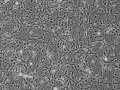 人星形胶质细胞