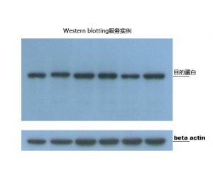 免疫蛋白印迹(Western blotting)-免疫蛋白印迹法的原理