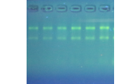 石蜡切片RNA提取、转录及qPCR验证-石蜡切片提取dna
