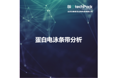 蛋白电泳条带分析