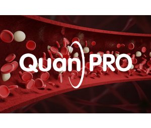 QuanPRO蛋白定量质谱系统