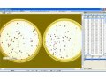 万深HiCC-A1型2皿全自动菌落计数分析仪