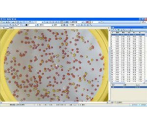 全自动菌落计数抑菌圈β-内酰胺酶细胞分析 