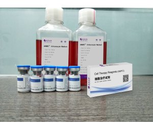 NKT细胞培养试剂盒