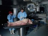 BBC拍片首次揭幕肥胖者“器官”2