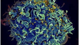 eLife：HIV感染不能够被治愈是因为HIV存在于我们的DNA中&nbsp;