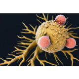 研究揭示新型免疫细胞有助于肿瘤免疫治疗