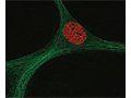细胞增殖与细胞生长曲线实验(CCK