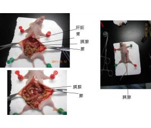 裸鼠胰腺癌原位模型构建