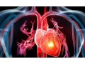 心血管系统疾病